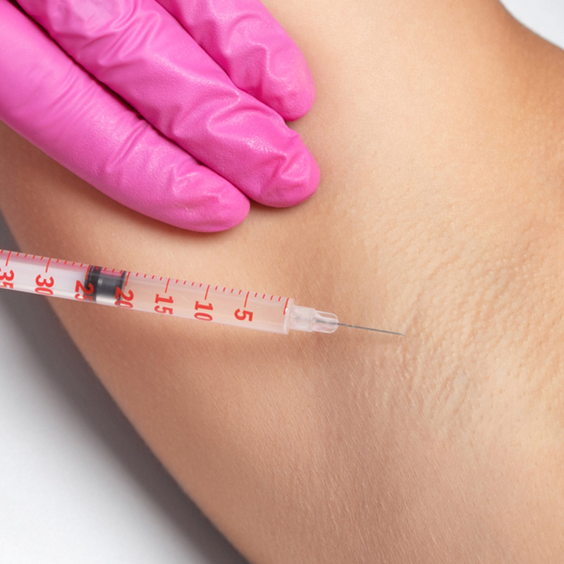 بوتاکس زیر بغل